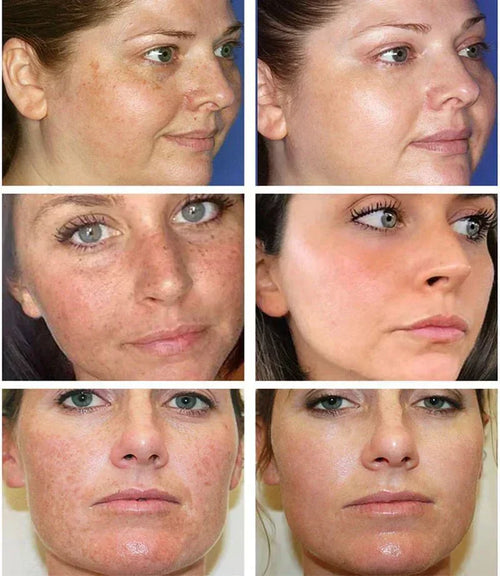 Productiva  - Dark Spot Corrector Remover™