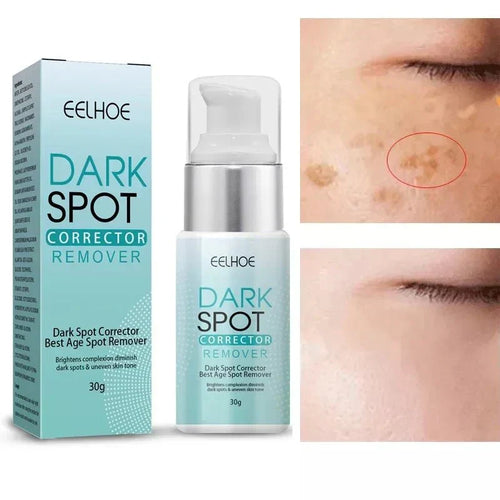 Productiva  - Dark Spot Corrector Remover™