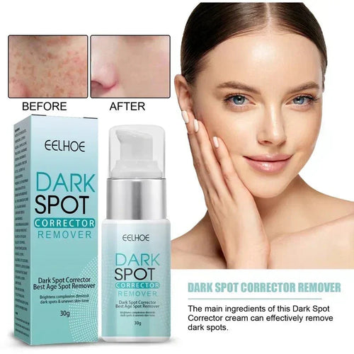 Productiva  - Dark Spot Corrector Remover™