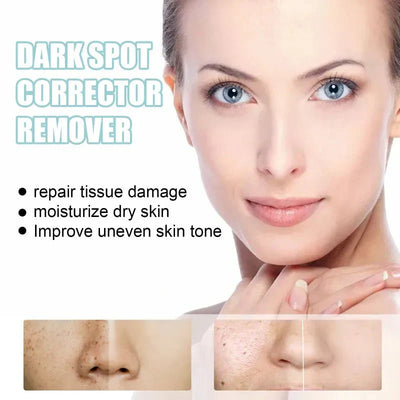 TumTum ™ - Dark Spot Corrector Remover - TumTum