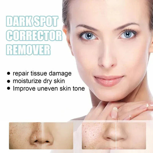 Productiva  - Dark Spot Corrector Remover™